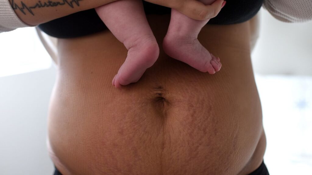 Postpartum mother's stomach with baby's feet